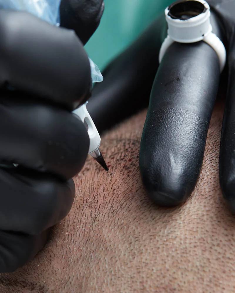 Scalp Micropigmentation Training Class – Permanent Makeup of Atlanta: scalp micropigmentation training course 800x
